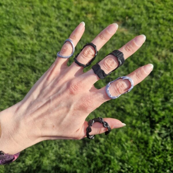 decorative-ring-splints-UK